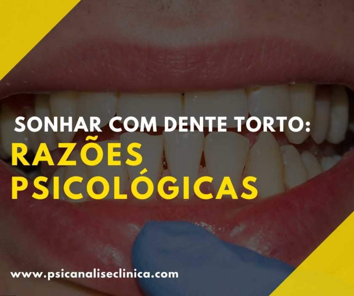 Featured image of post Sonhar Com Dente Encavalado Contudo necess rio destacar que a depender da pessoa e do momento em que ela est o significado para esse sonho muda bastante